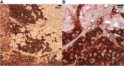 Immunohistochemical Labeling of Low-Density Lipoprotein Receptor and Scavenger Receptor Class B Type 1 Are Increased in Canine Lymphoma